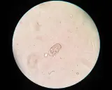 Mikroskopische Aufnahme eines Kokzidien-Oozysten, typisch für Kokzidiose bei Kaninchen.
