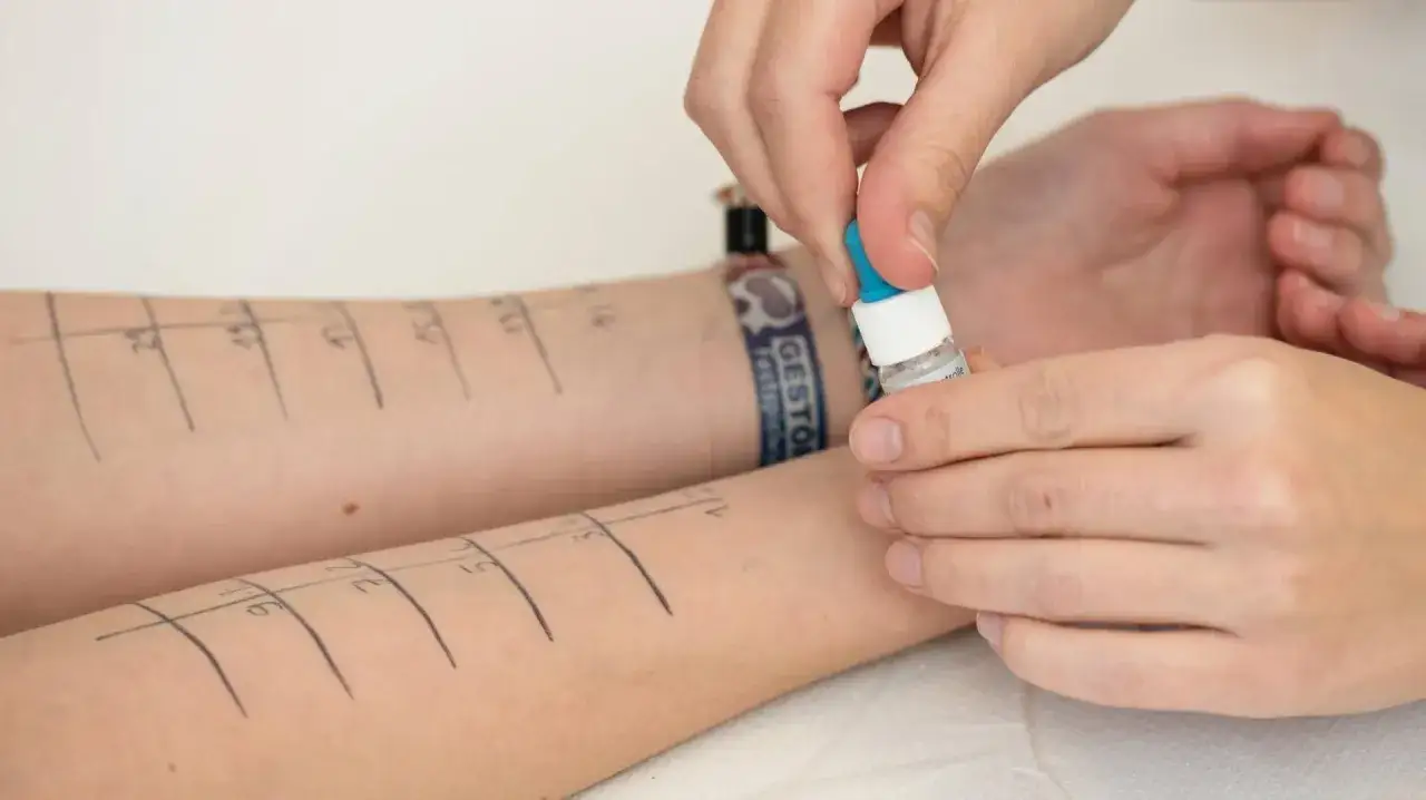 Allergietest am Arm: Kleine Tropfen werden auf markierte Stellen aufgetragen, um eine mögliche Kaninchenallergie zu diagnostizieren.